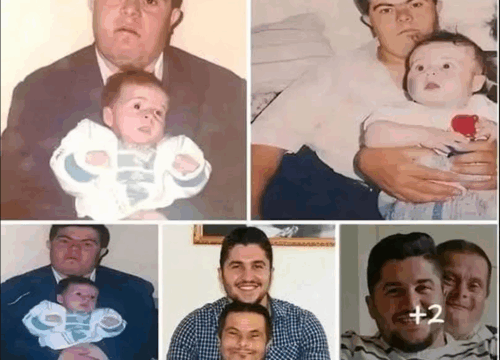 A father with Down syndrome raised his son, who is now a doctor