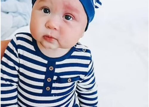 “Gold Coast Mother Labeled a ‘Monster’ for Using Laser Treatment on Her Son’s Port-Wine Stain Birthmark”