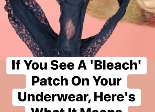 “What It Means If You Notice a ‘Bleach’ Patch on Your Underwear”