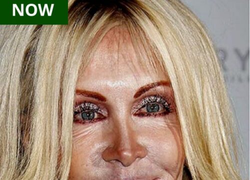 “Absolutely Unrecognizable! Who Is This Woman? Once a Huge Star, She’s Changed Drastically Over Time.”