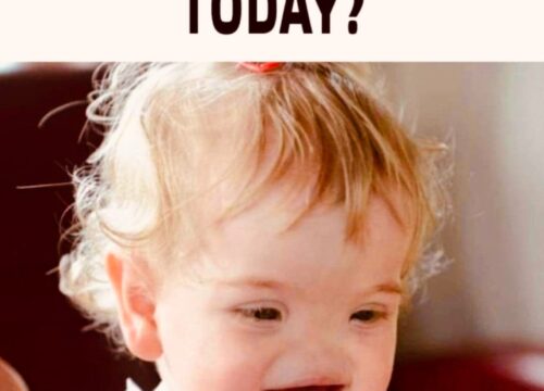 “What the ‘Noseless Girl’ Looks Like Today”