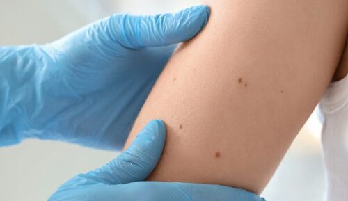 He Was 18 and Full of Life—Then Cancer Symptoms Silently Took Over