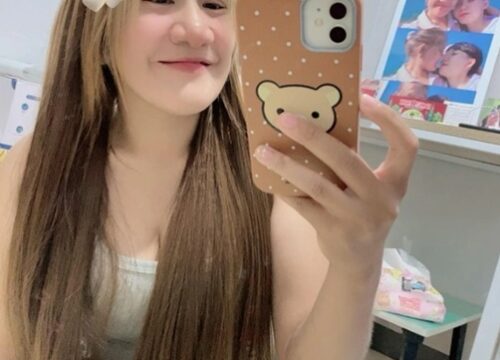 Once Called the ‘World’s Hairiest Girl,’ Now a Confident Woman in Love: Natty’s Remarkable Transformation