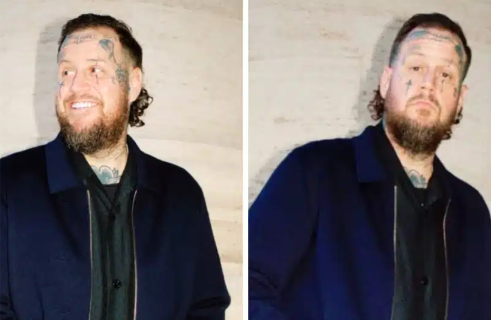 After Losing 200 Pounds, Jelly Roll Is Eligible to Wear Louis Vuitton and Stuns Fans