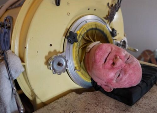 “76-Year-Old Man, Paralyzed by Polio at Age 6, One of the Last to Use an Iron Lung: ‘My Life Is Incredible’”