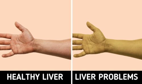 8 Body Warning Signs You Shouldn’t Ignore