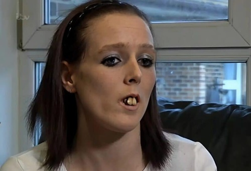 This Girl Became an Internet Sensation Due to Her Appearance — See Her Stunning Transformation Post-Surgery