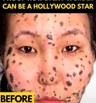 Goar Avetisyan: Transforming Pain Into Art and Beauty