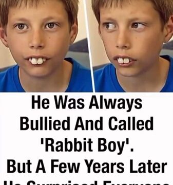 Bullied Boy Called “Rabbit” Because of His Teeth Undergoes Stunning Transformation