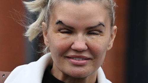 Kerry Katona’s Striking New Look: A Star Unafraid to Transform Herself and Her Life