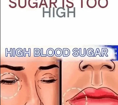 12 Key Indicators of High Blood Sugar and How to Manage Them Early