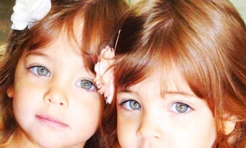 They Were Dubbed the “Most Beautiful Twins in the World” — What Happened Next Will Surprise You
