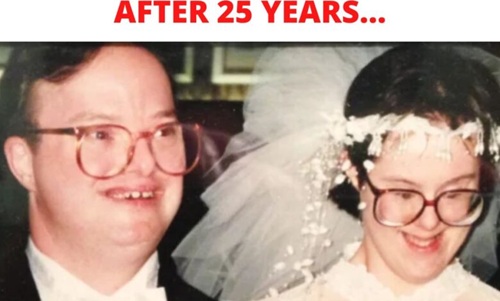 Their love defied all odds—and made history as Britain’s first married couple with Down syndrome.