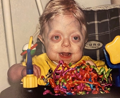 “Born With No Hope of Survival — Today, He’s Fighting Fires and Inspiring Millions.”