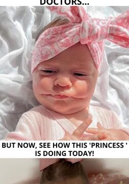 What looked like an adorable smile on their baby turned into a jaw-dropping diagnosis no one expected.