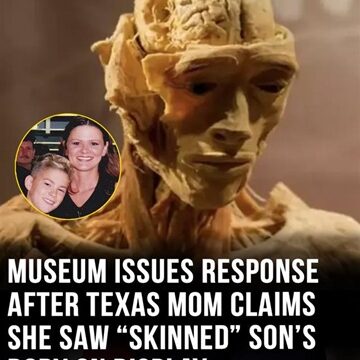 Mom claims her son’s “skinned” body was exhibited — museum breaks silence