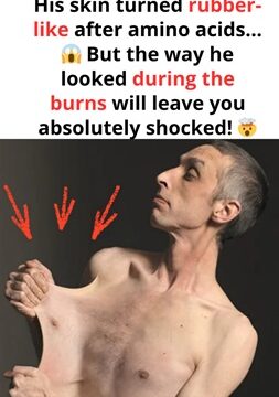 He Has a Unique Talent: His Skin Can Stretch Like Elastic, Making Him a Guinness Record Holder!