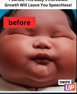 A 15-Pound Newborn? This Baby’s Unbelievable Progress Will Blow Your Mind — Check Out the Pictures!