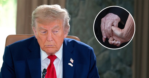 Health Fears Intensify as Trump Shows Off His ‘Wrinkled Hands’