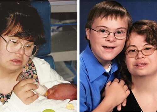 Couple Living with Down Syndrome Decide to Have Children, Draws Criticism