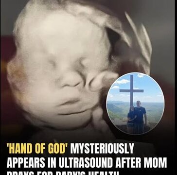 Mother sees ‘God’s hand’ holding her baby’s head in ultrasound image