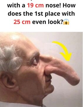 “Thomas Wedders: The Man With the Longest Nose Who Captivated the 1700s”