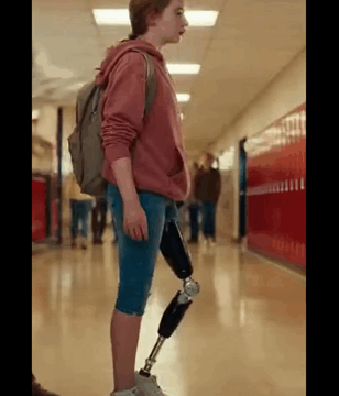They Mocked Me for My Prosthetic Leg — But Then the Black SUVs Showed Up.